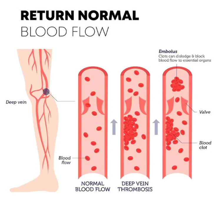NervoSocks™ – Neuropathy Pain Relief Socks