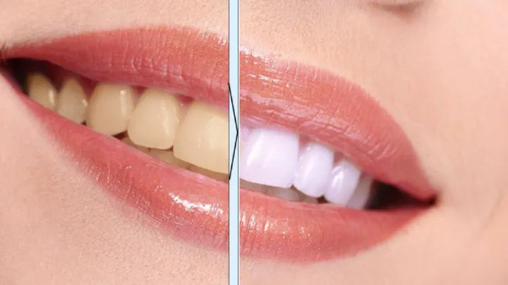 Teeth Whitening Pen - side view