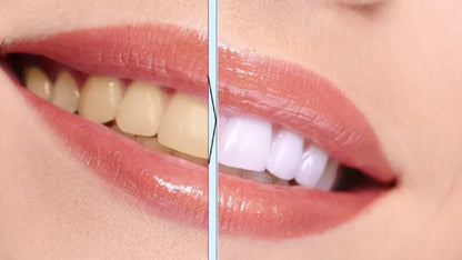Teeth Whitening Pen - side view