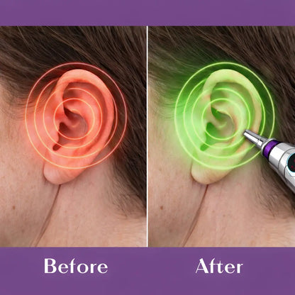 NeuraTouch Nerve Relief Pen by Xeviola